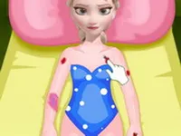 Elsa Skateboard Accident
